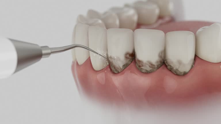Trusted Teeth Cleaning And Checkup service in Woodway, WA - Dentist Open Now